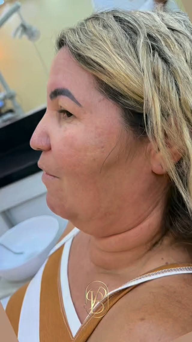 Rejuvenescimento